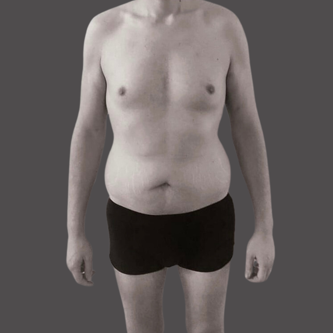 un uomo grasso e fuori forma prima percorso VIS Fit